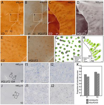 Immunoreactivity of Vesicular Glutamate Transporter 2 Corresponds to Cytochrome Oxidase-Rich Subcompartments in the Visual Cortex of Squirrel Monkeys